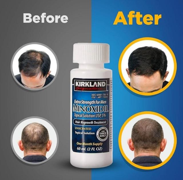 ❇️Orginal MINOXIDIL